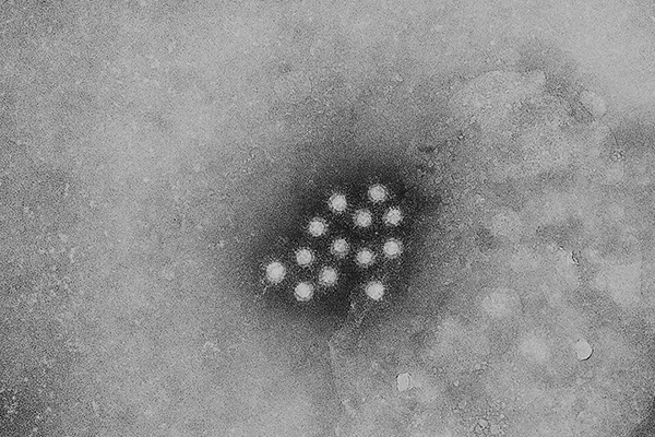 Hepatitis A viruses